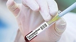 Обнаружено больше 2,5 тысяч случаев заражения коронавирусом 