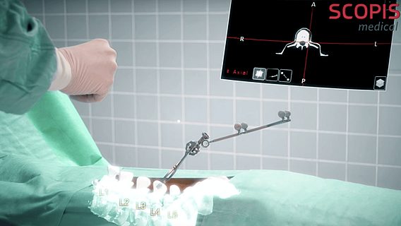 HoloLens от Microsoft поможет в проведении хирургических операций 