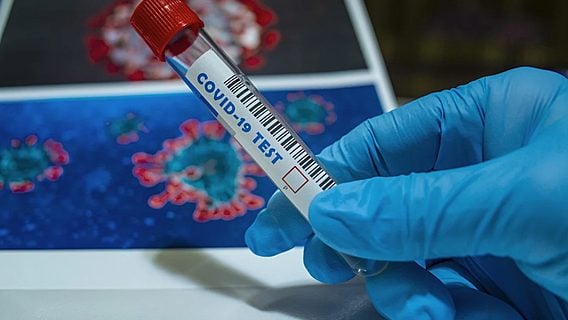 Количество выявленных случаев коронавируса выросло до 51,8 тысячи — Минздрав