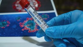 Число выявленных случаев коронавируса в Беларуси выросло до 64,6 тысячи