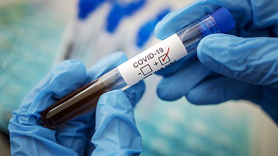 В Беларуси уже больше 20 тысяч подтверждённых случаев коронавируса 