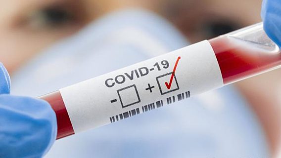 Резидент ПВТ хочет зарегистрировать собственный тест на коронавирус