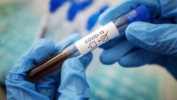 Минздрав подтвердил 61 475 случаев коронавируса